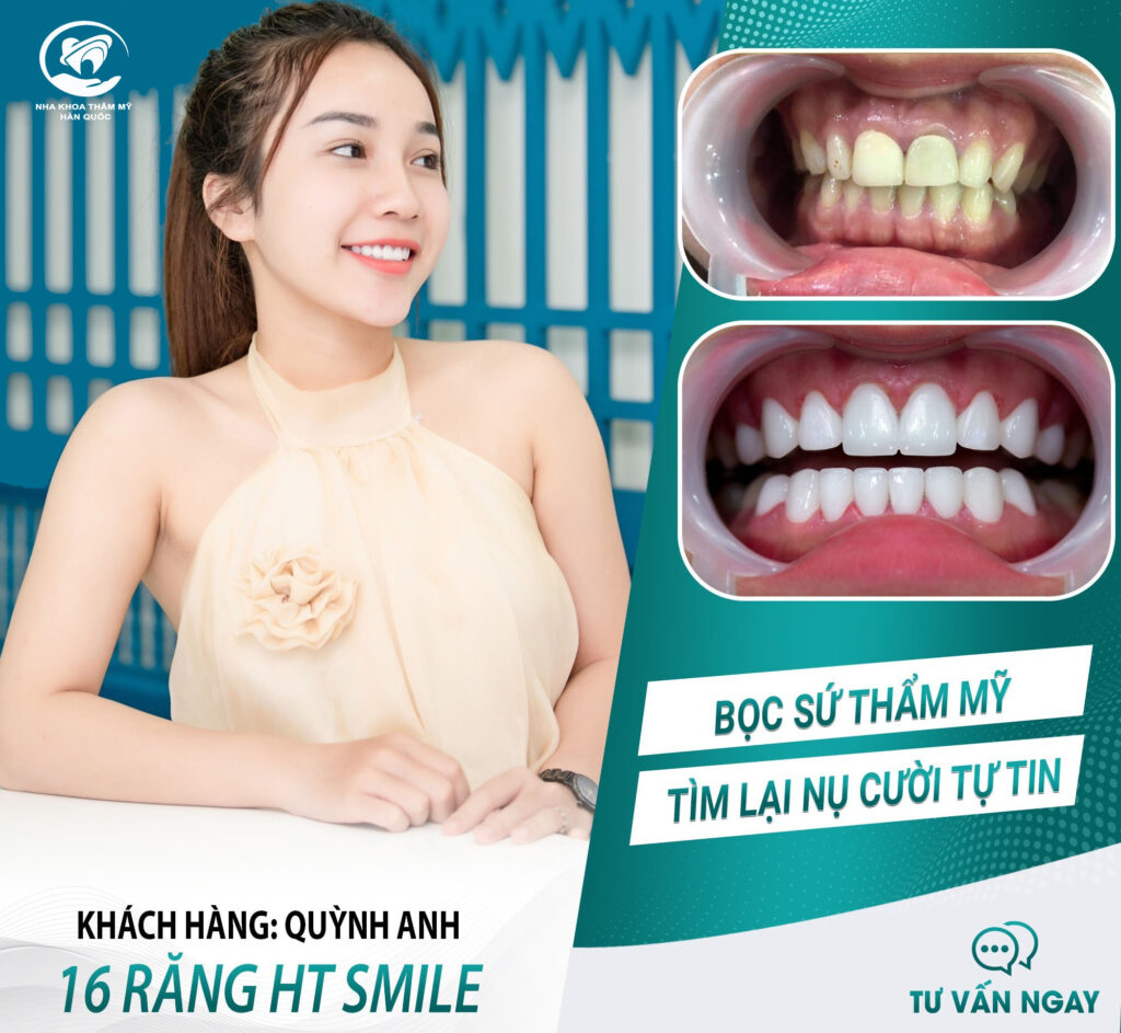 Nha khoa Thẩm mỹ viện Hàn Quốc