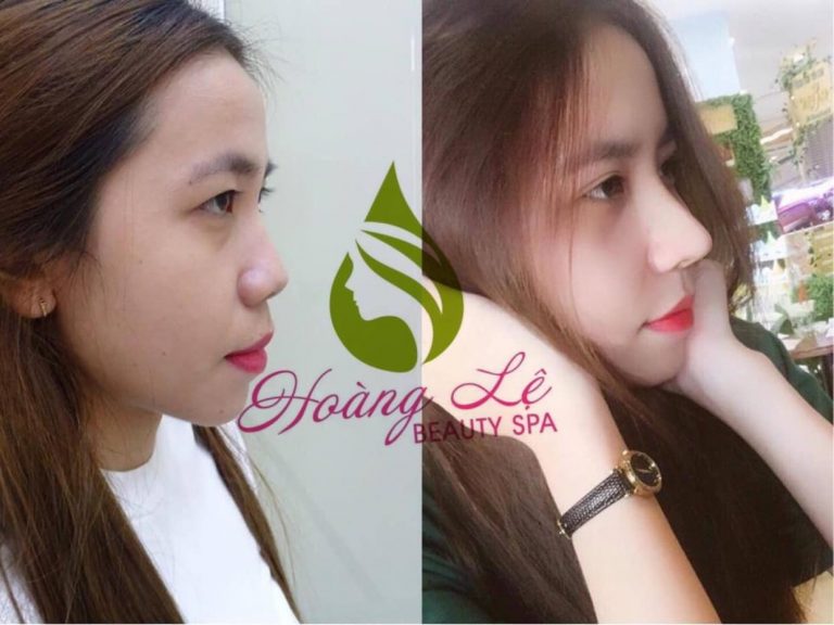 Spa Hoàng Lệ