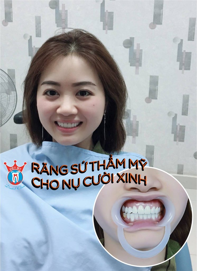 Nha Khoa Việt Mỹ - Quảng Bình